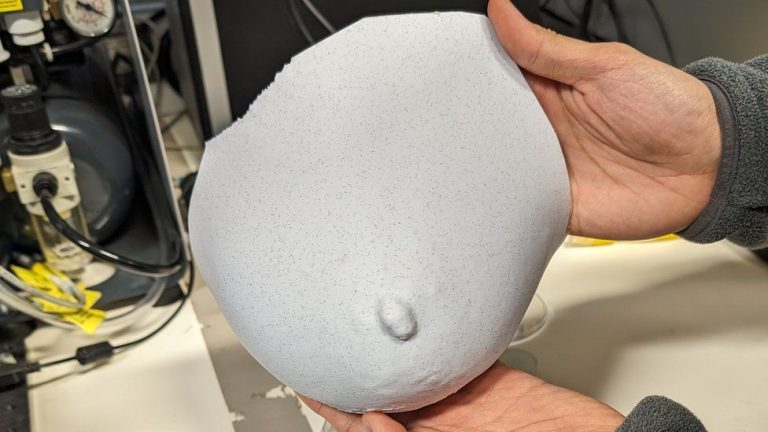 3D Printing Enhances Breast Reconstruction Surgery Efficiency